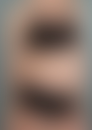 Transformare slăbire înainte